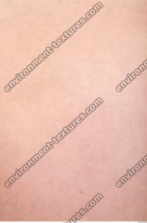 photo texture of white skin 0012